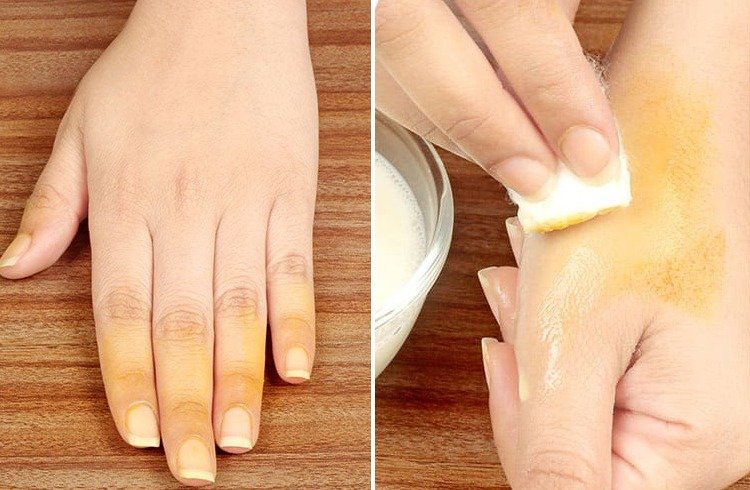 how-to-remove-turmeric-stains-from-skin-nails-with-household-items